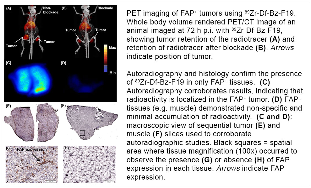 PET imaging of FAP+ tumors using 89Zr-Df-Bz-F19